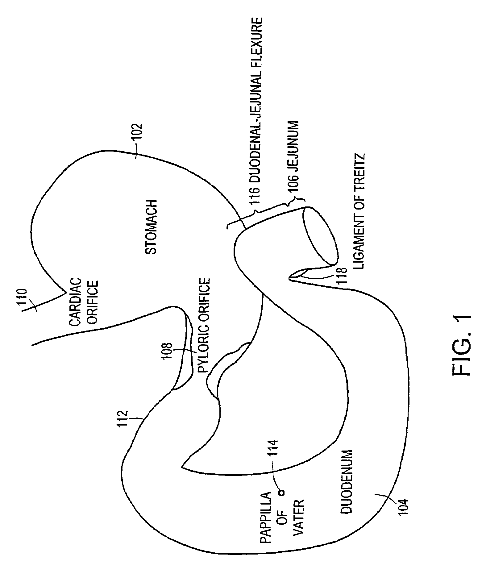 Atraumatic delivery devices