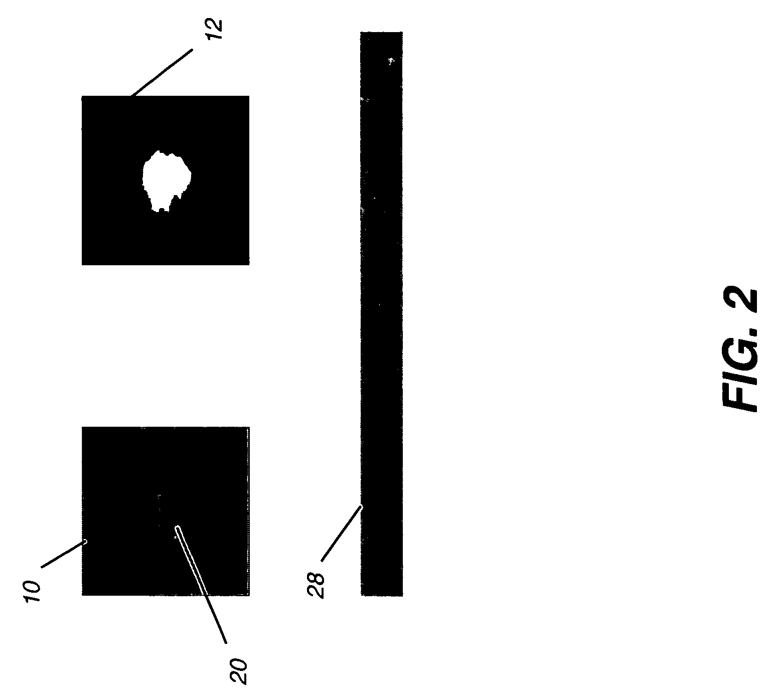 Texture analysis for mammography computer aided diagnosis