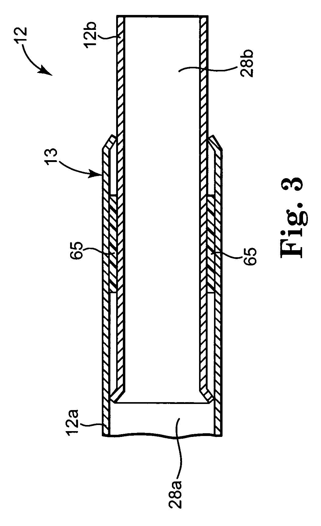 Disposable endoscope sheath having adjustable length