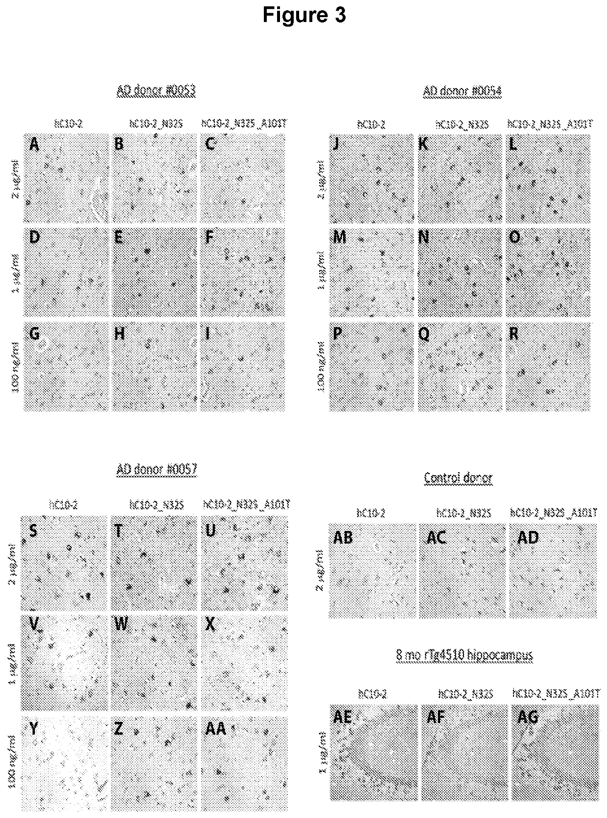 Antibodies specific for hyperphosphorylated tau and methods of use thereof