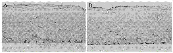 Construction method for in vitro skin test model containing melanocytes