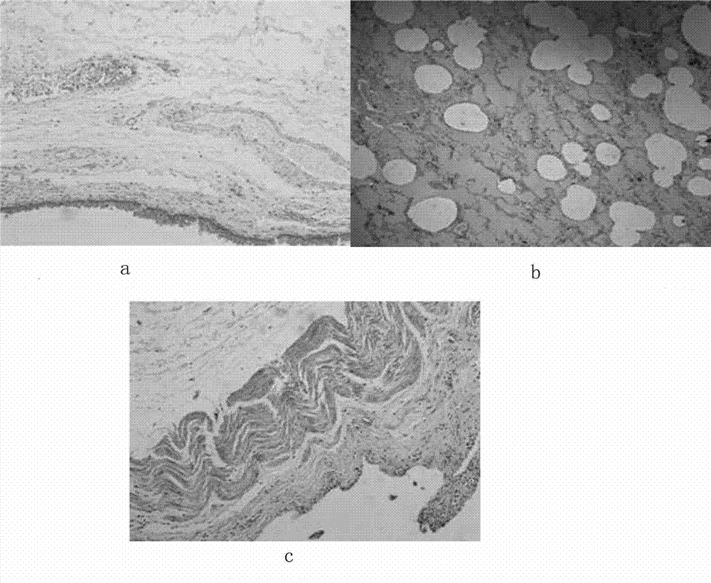 Immunohistochemical SIMPLE same part marker diagnosis method and kit for pathologic autopsy anaphylactic shock