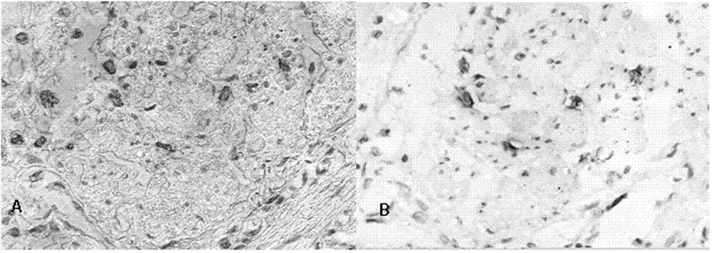 Immunohistochemical SIMPLE same part marker diagnosis method and kit for pathologic autopsy anaphylactic shock