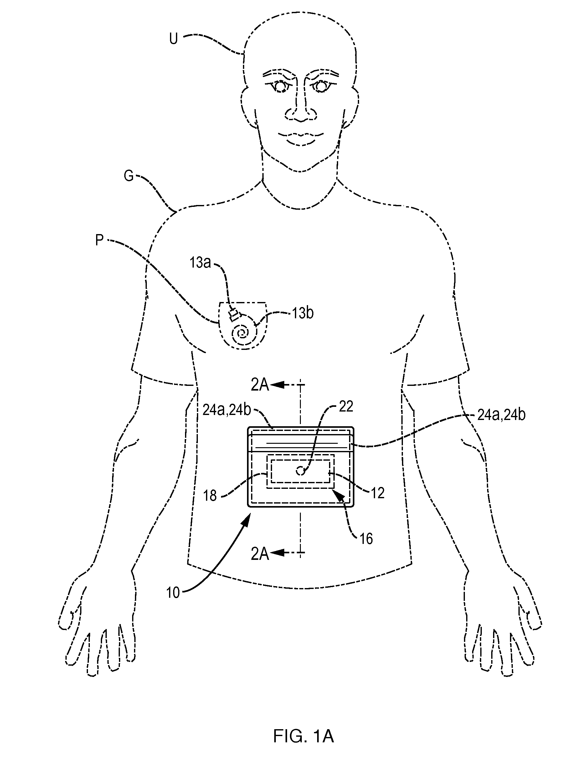 User interface securing assembly