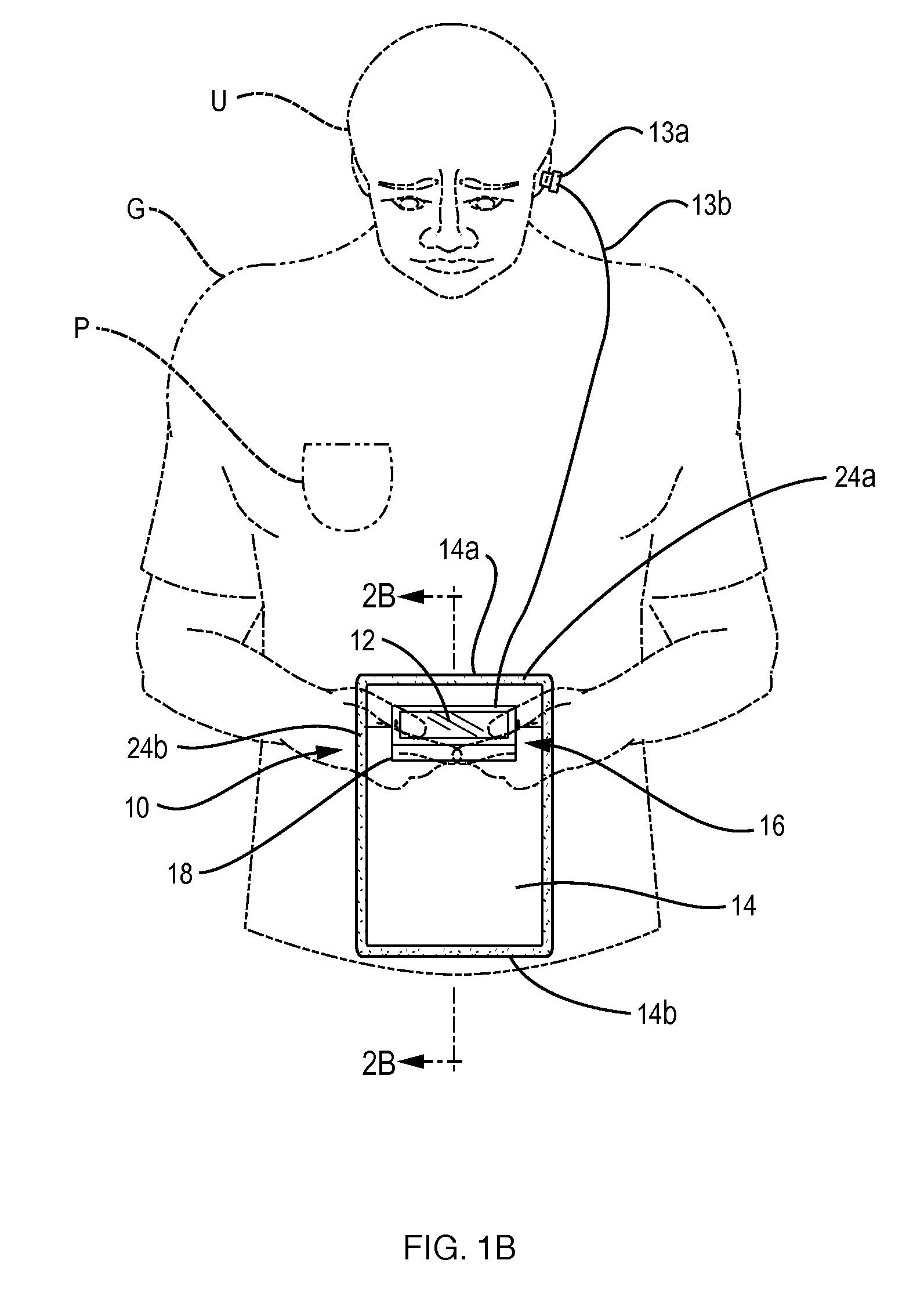 User interface securing assembly