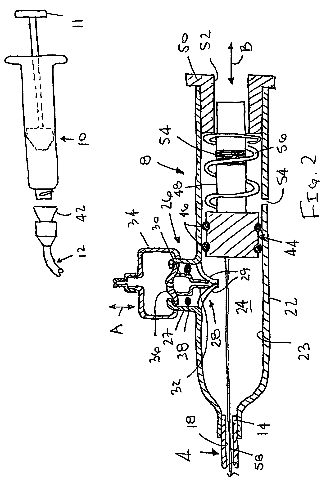 Apparatus and method for temporary hemostasis