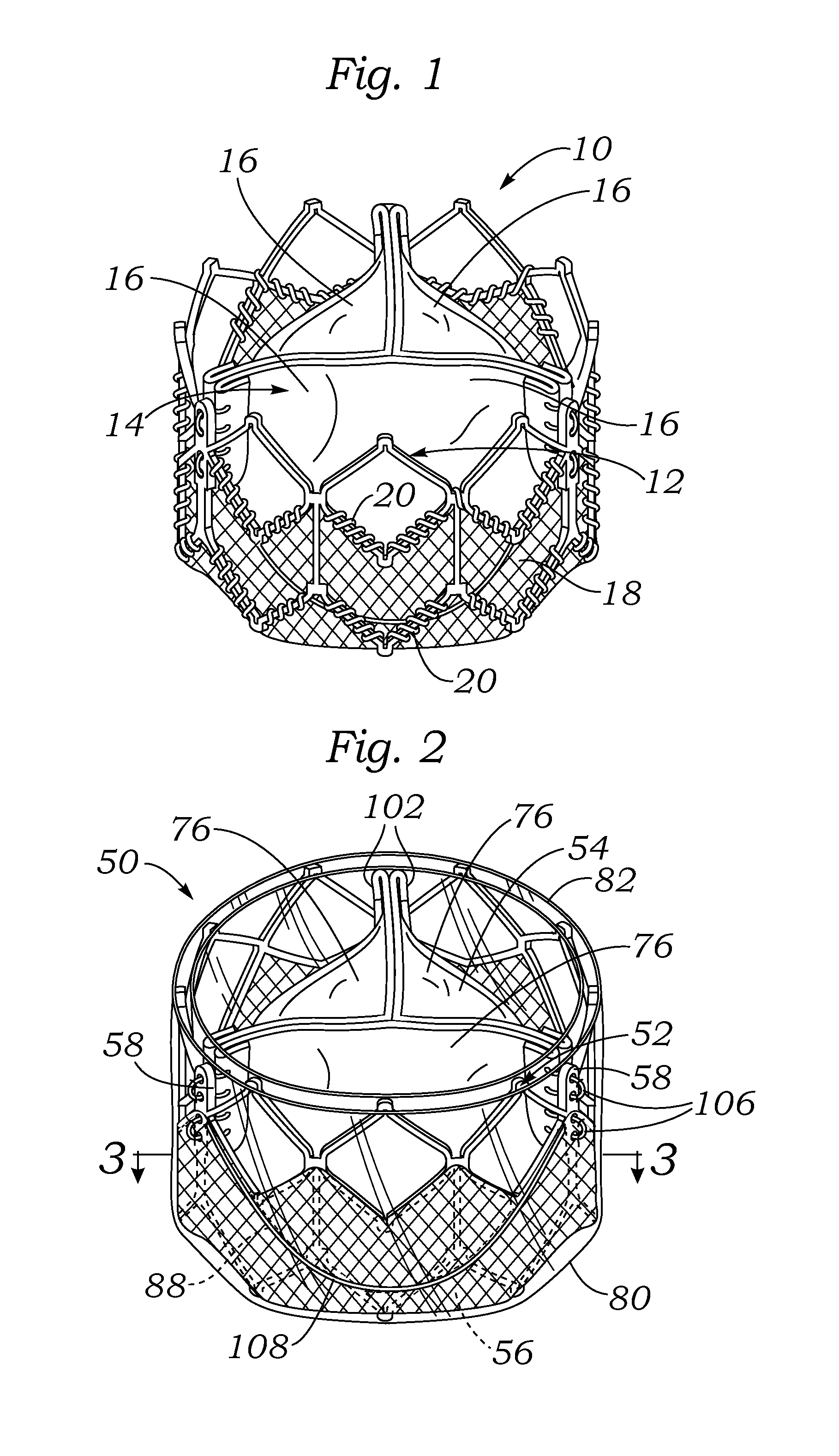 Methods of making encapsulated heart valves