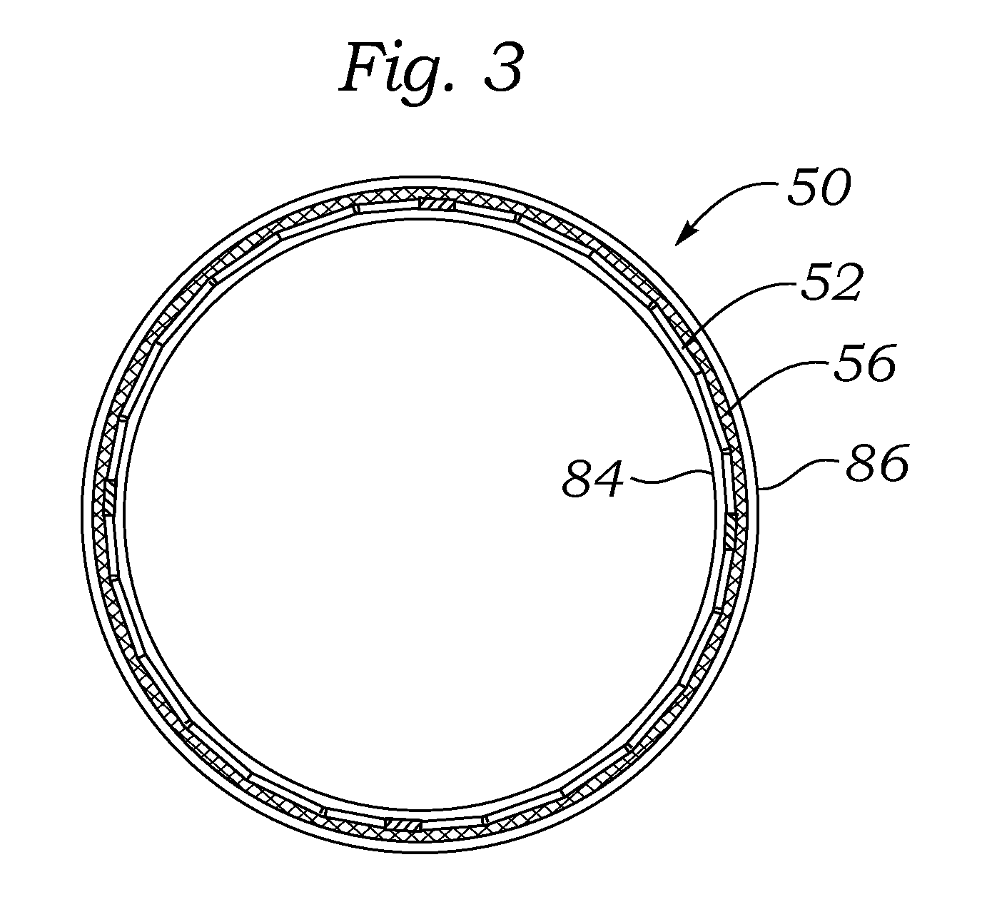 Methods of making encapsulated heart valves