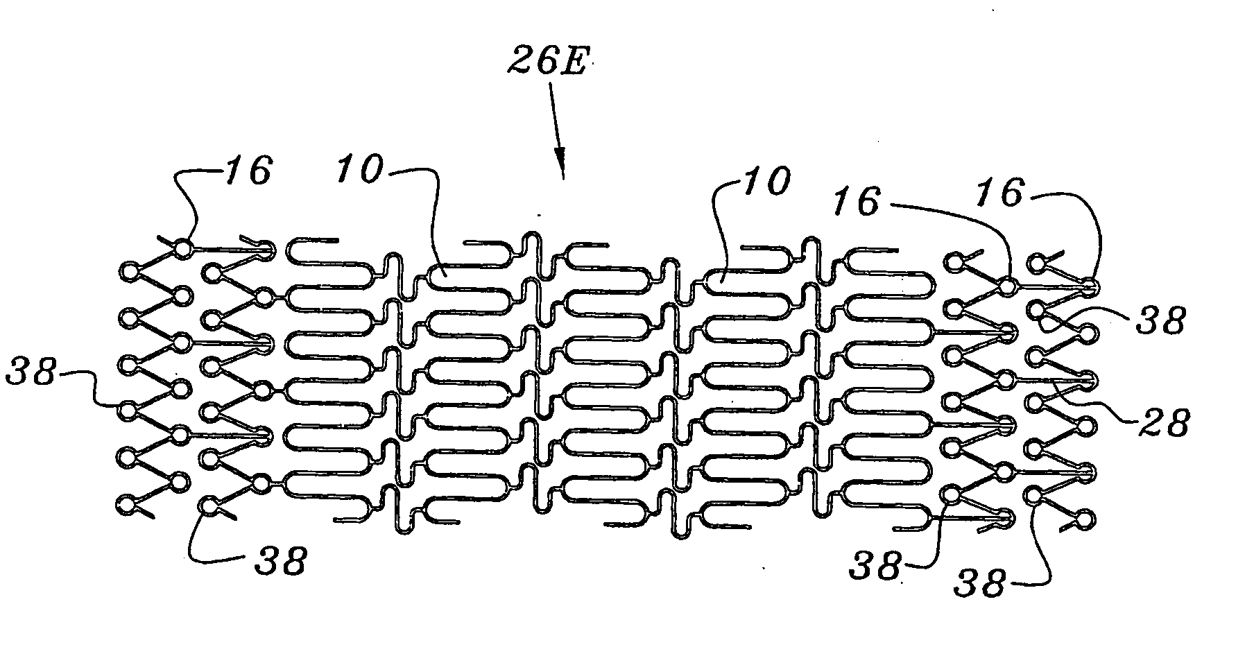 Structurally variable stents