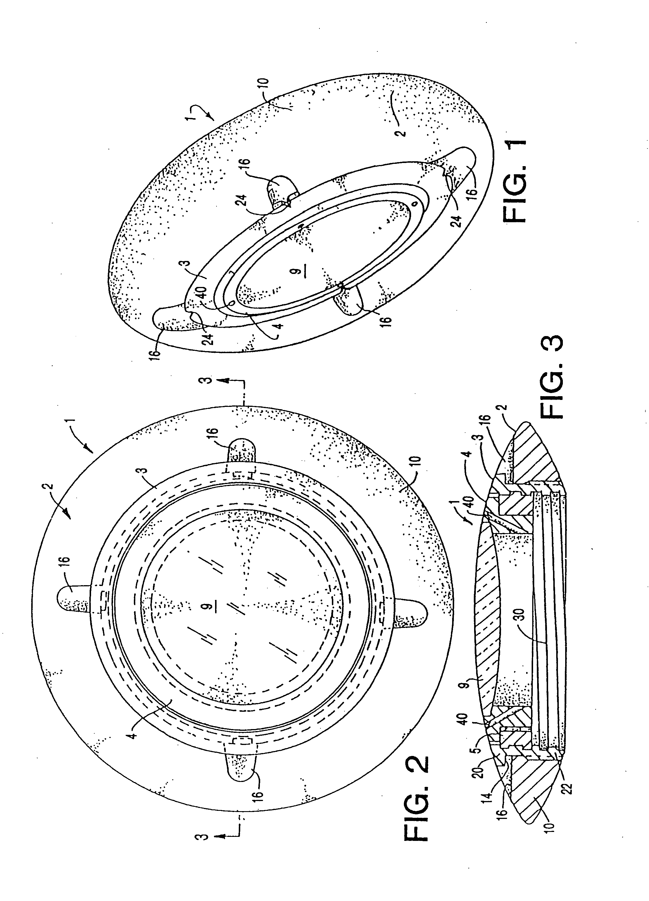 Modular intraocular implant