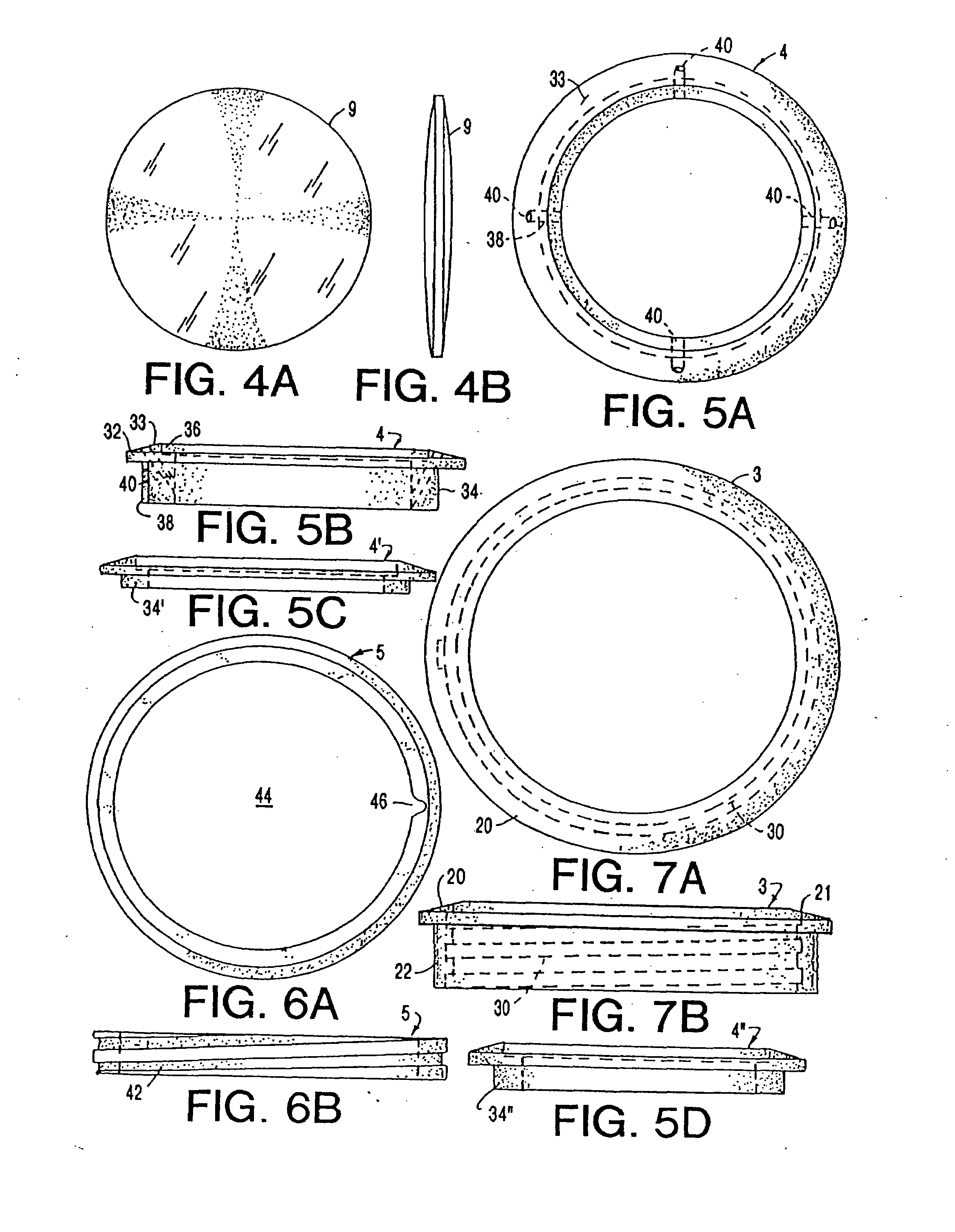 Modular intraocular implant