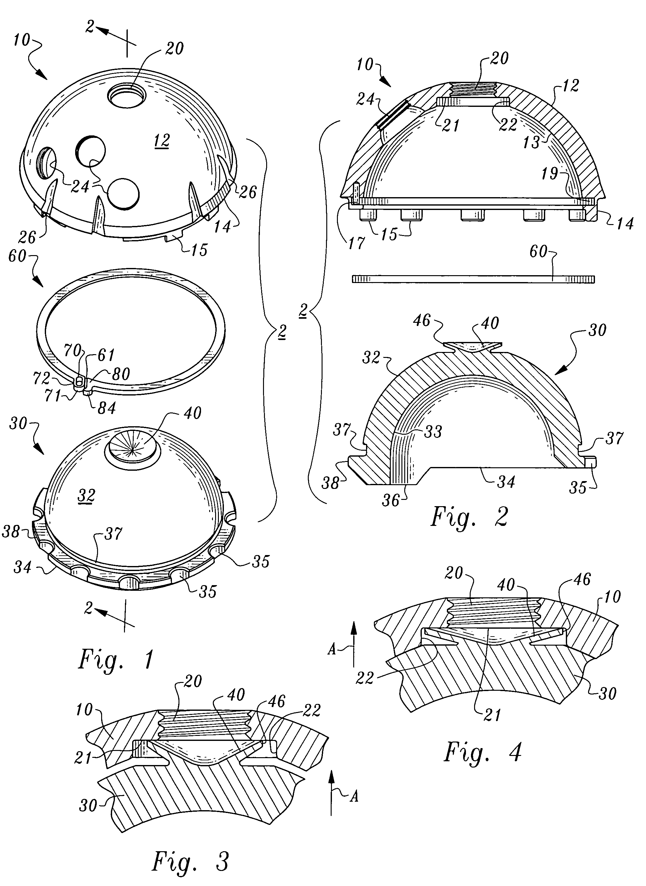 Locking ring for liner of acetabular cup