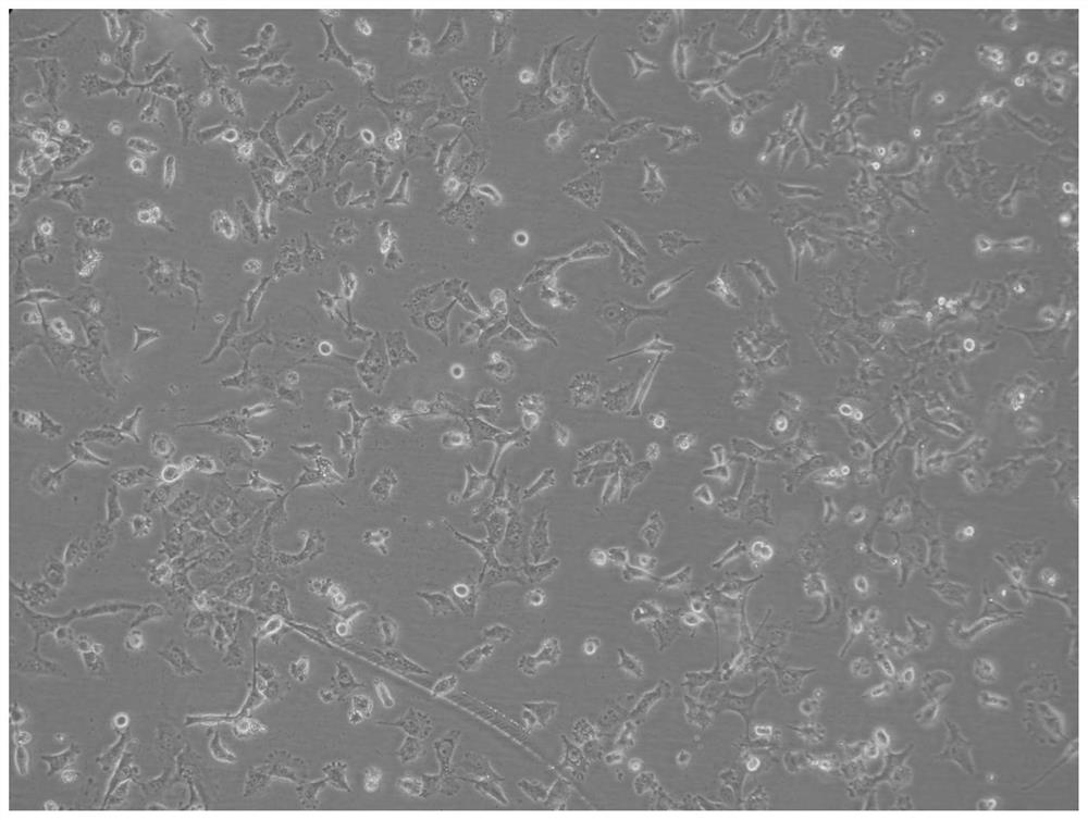 A human epidermal growth factor tyrosine kinase inhibitor acquired drug-resistant lung cancer cell line and its establishment method and application