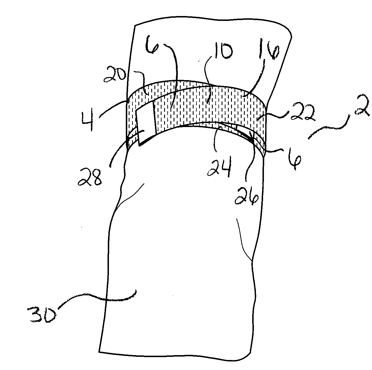 Bi-Directional Tourniquet