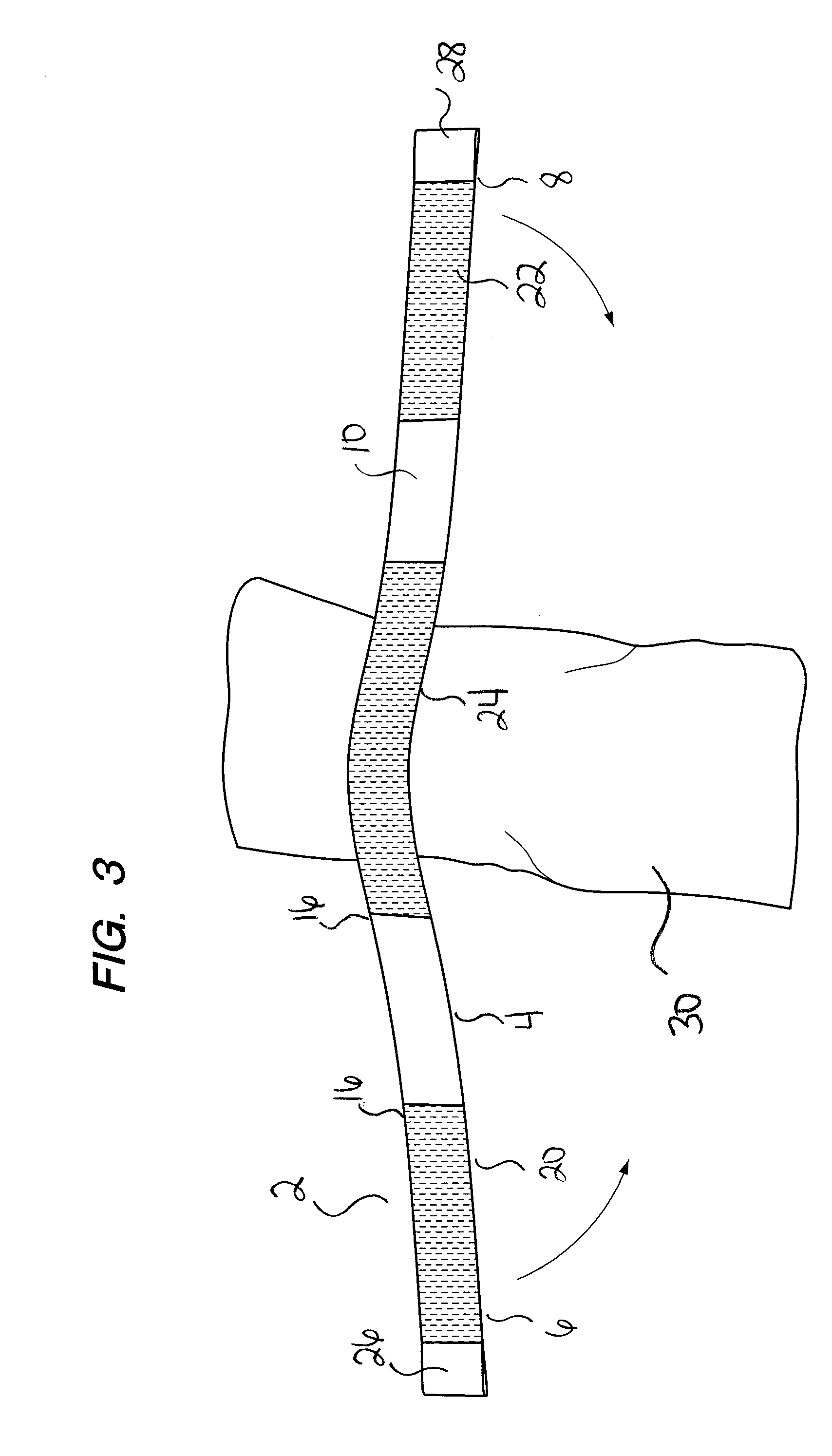 Bi-Directional Tourniquet