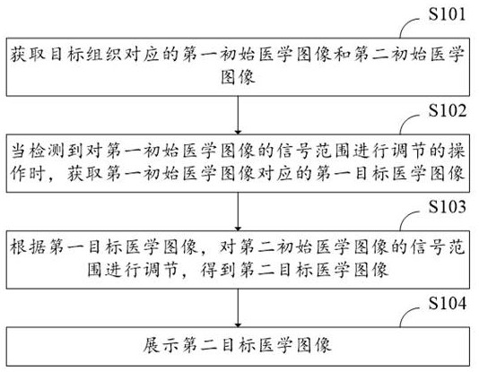 Medical image display method and device, computer equipment and storage medium