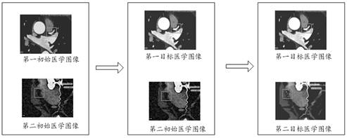 Medical image display method and device, computer equipment and storage medium