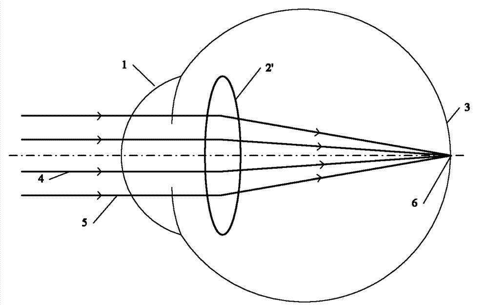 Artificial lens and manufacturing method thereof