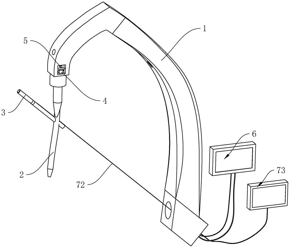 Fracture intramedullary fixation device and method