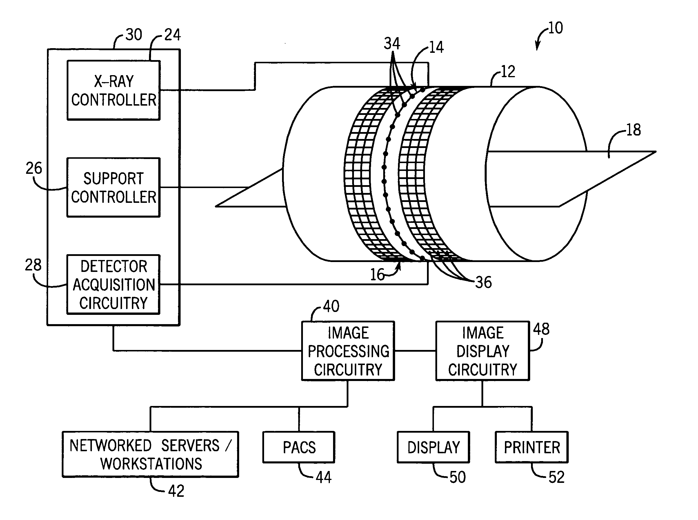 Reconstruction of CT projection data