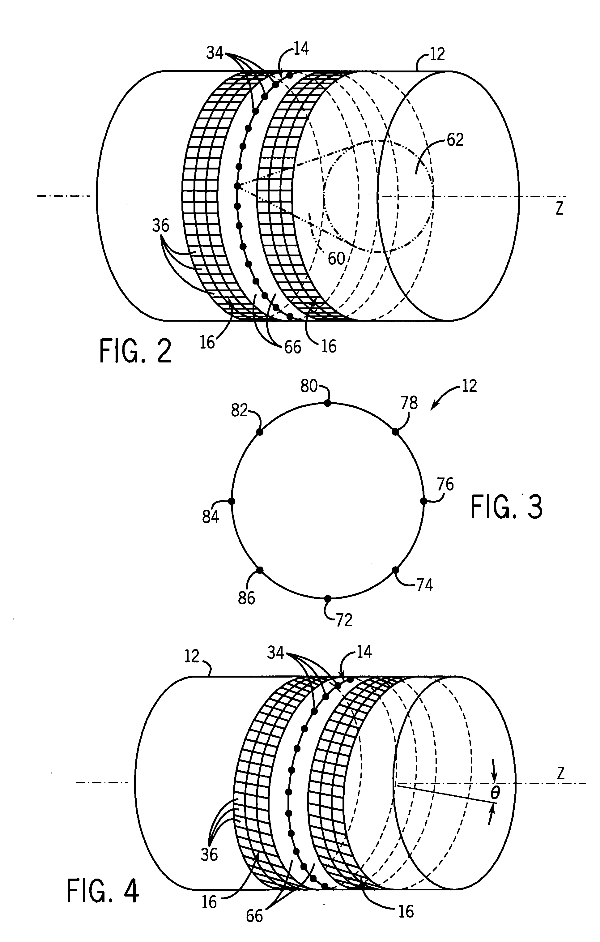 Reconstruction of CT projection data