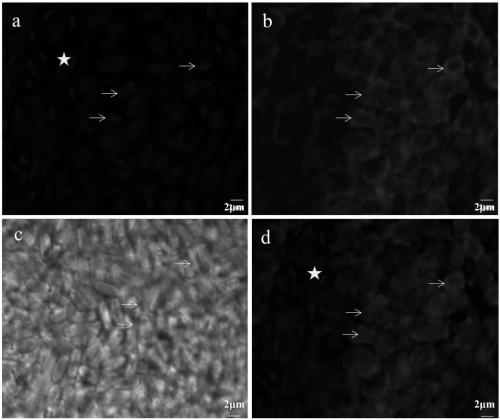 Specific marker Nagorno-Karabakh deformation microsporidia nucleic acid probe and fluorescence in-situ hybridization detection method thereof