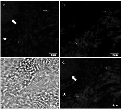 Specific marker Nagorno-Karabakh deformation microsporidia nucleic acid probe and fluorescence in-situ hybridization detection method thereof