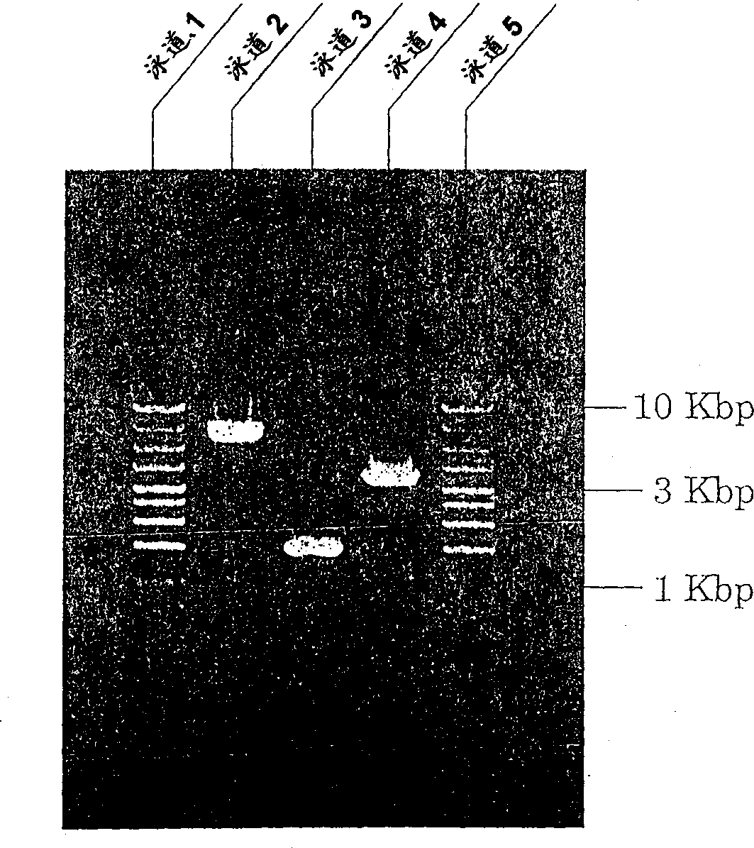 Analysis of predisposition based on buman airway tripsin protease gene polymorphism