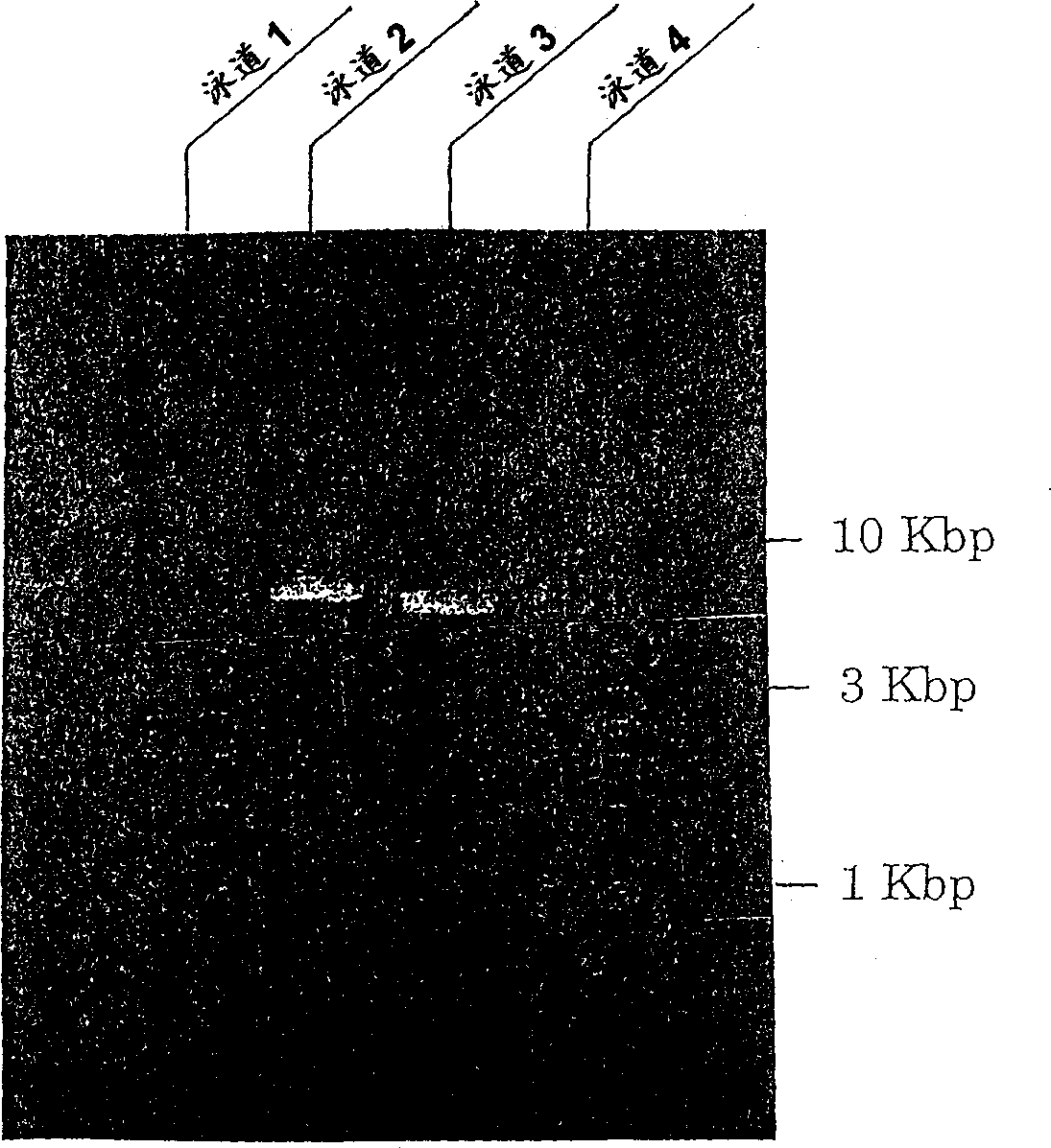 Analysis of predisposition based on buman airway tripsin protease gene polymorphism