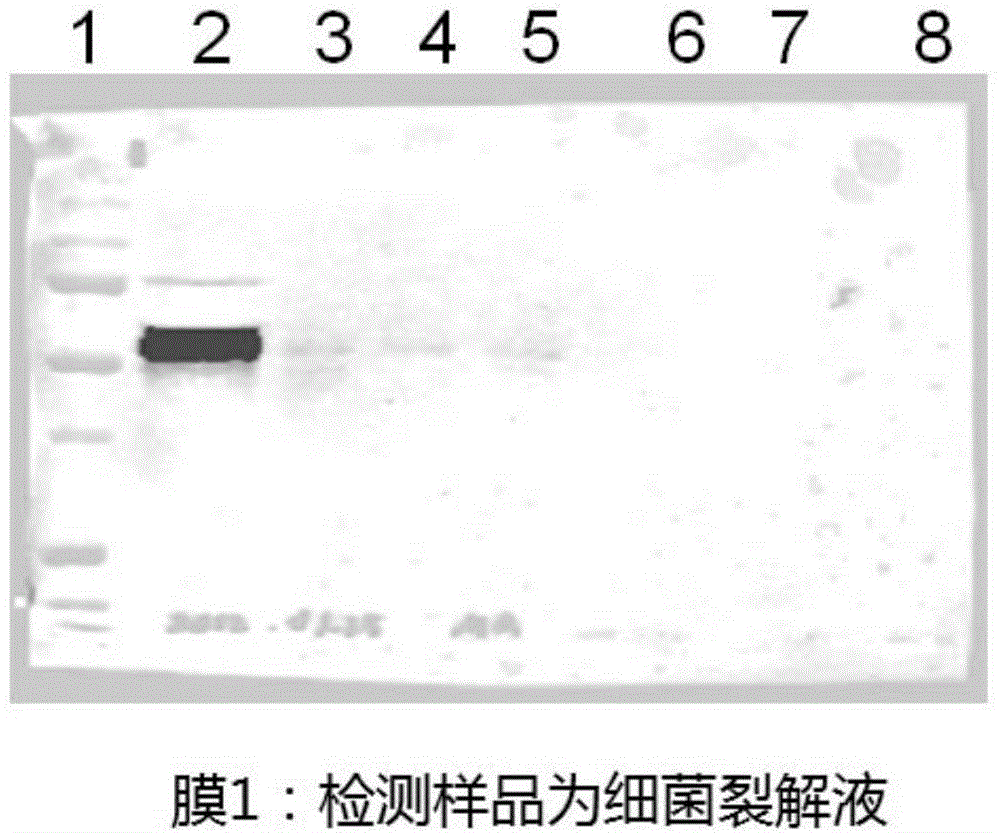 Enzyme-linked immunoassay kit for detecting methicillin-resistant staphylococcus aureus