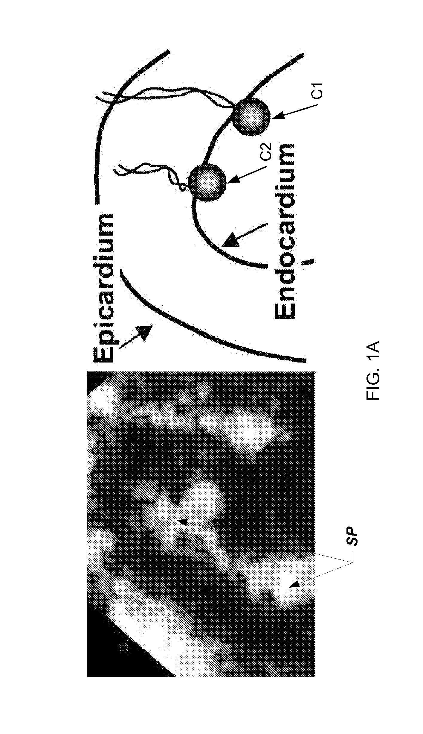 Steerable catheter navigation with the use of interference ultrasonography