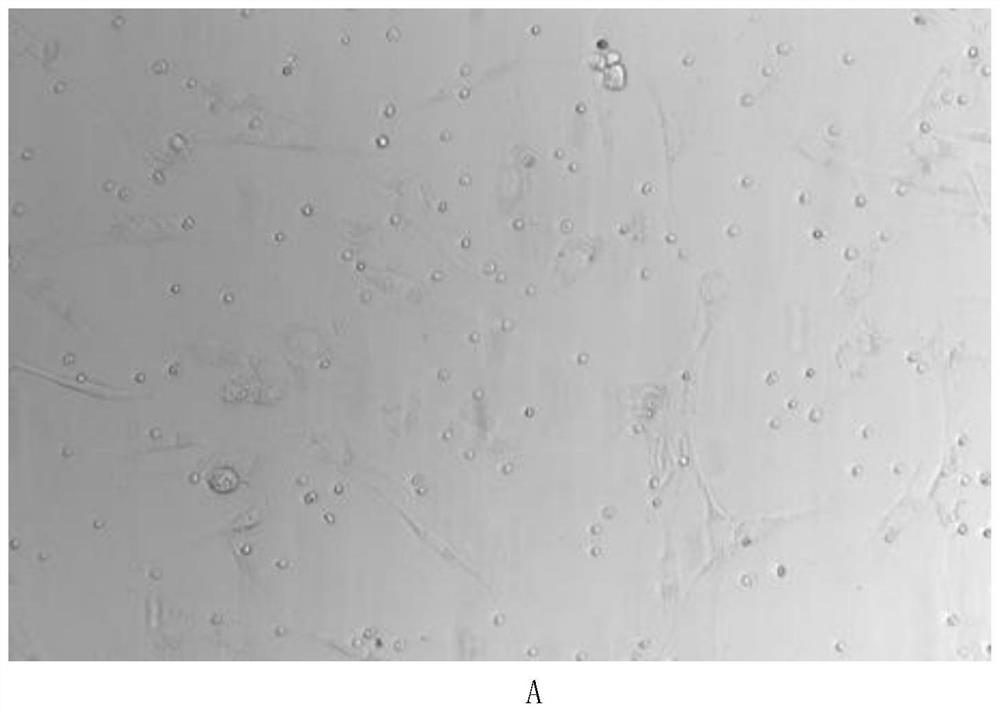 Method for efficiently separating and purifying porcine skeletal muscle satellite cells