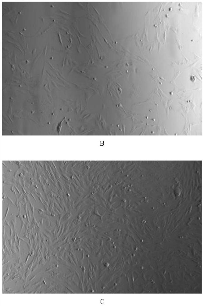 Method for efficiently separating and purifying porcine skeletal muscle satellite cells