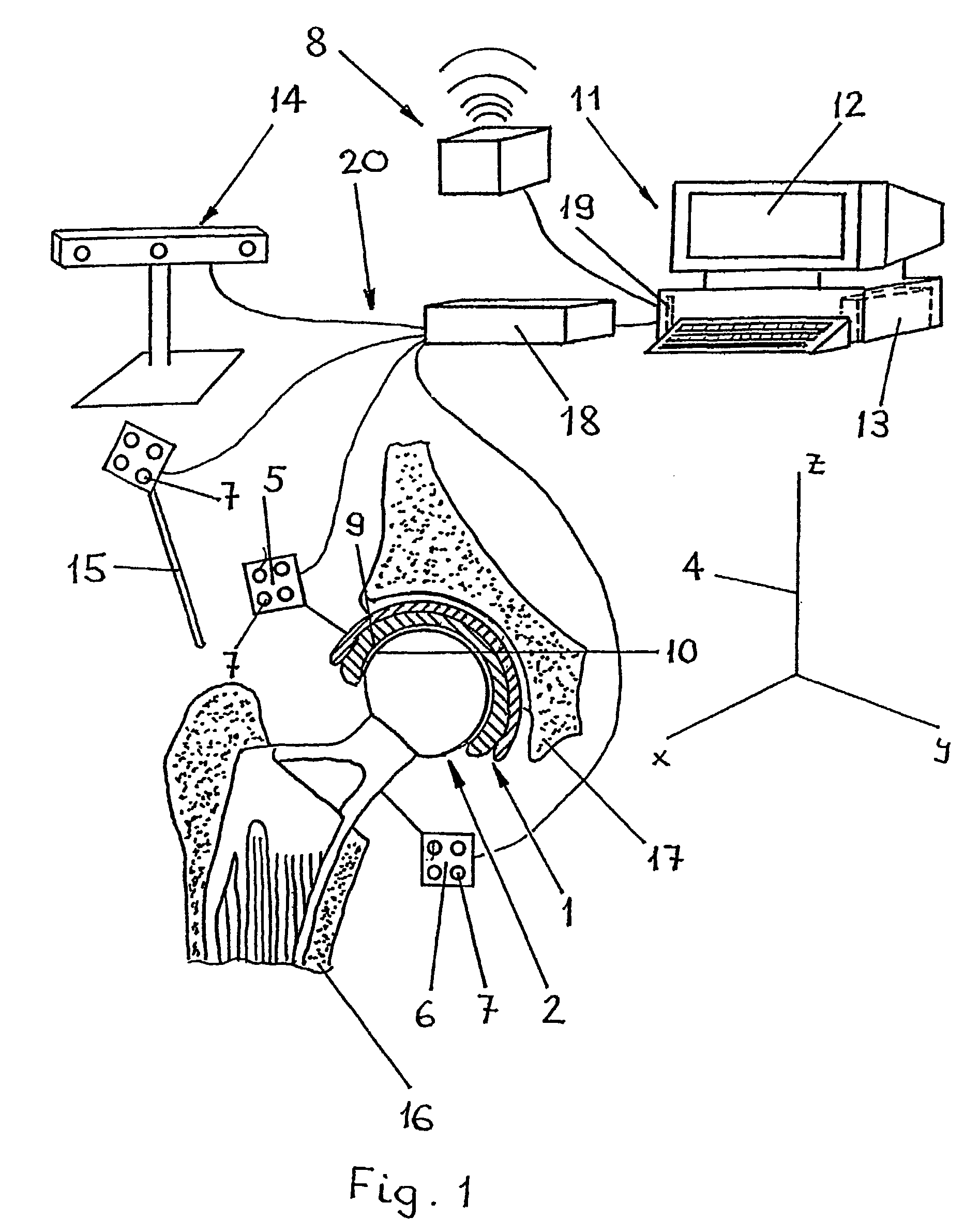 Method and device for impingement detection