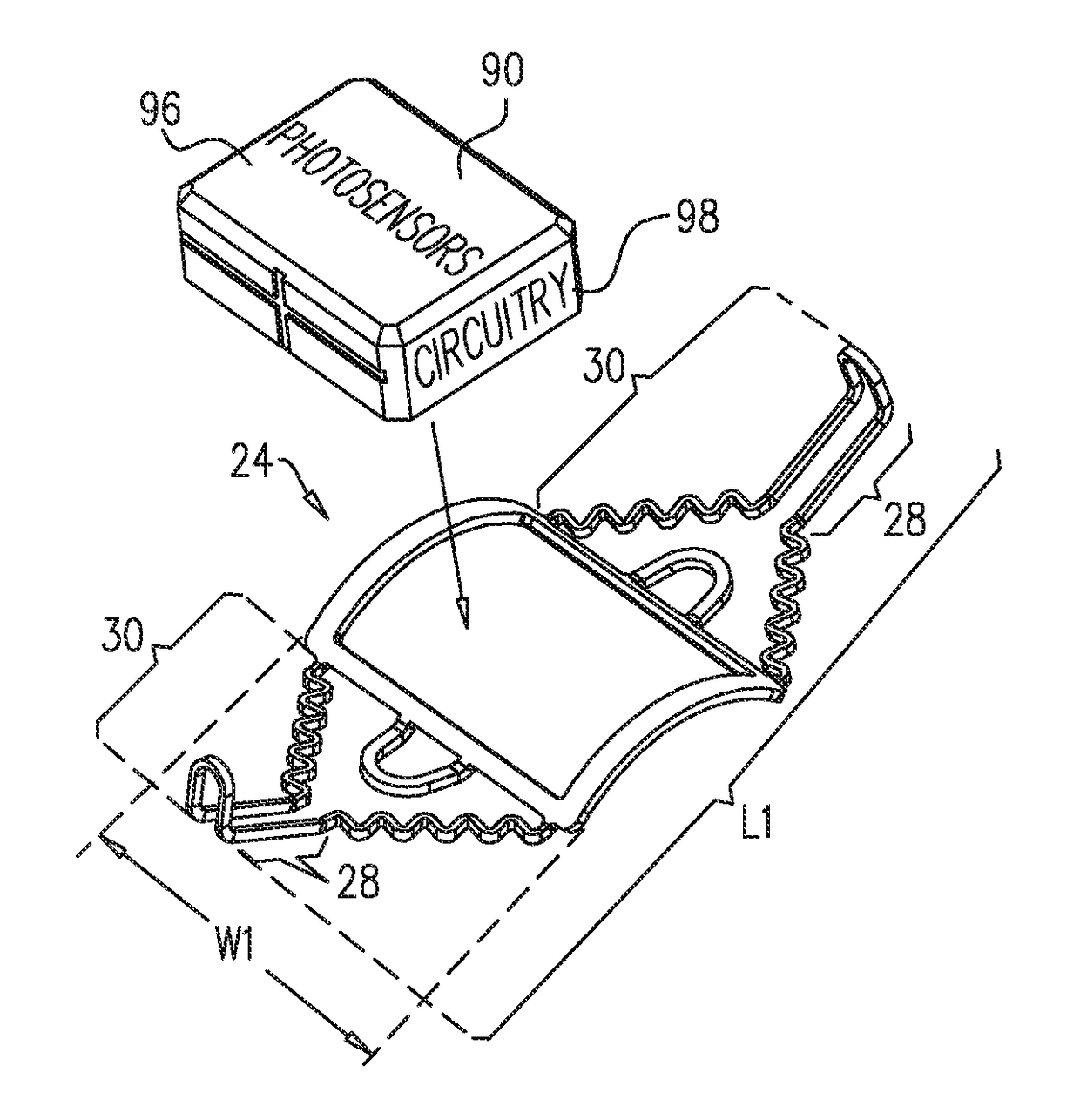 Retinal implant fixation