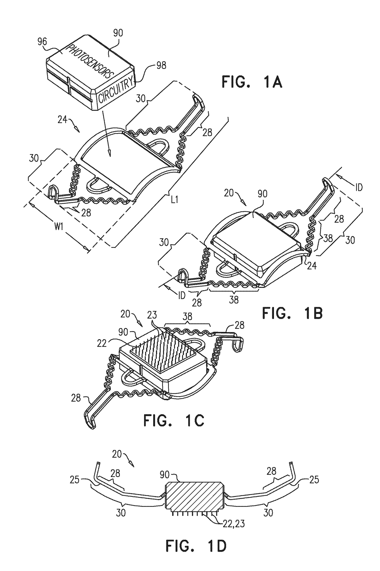 Retinal implant fixation