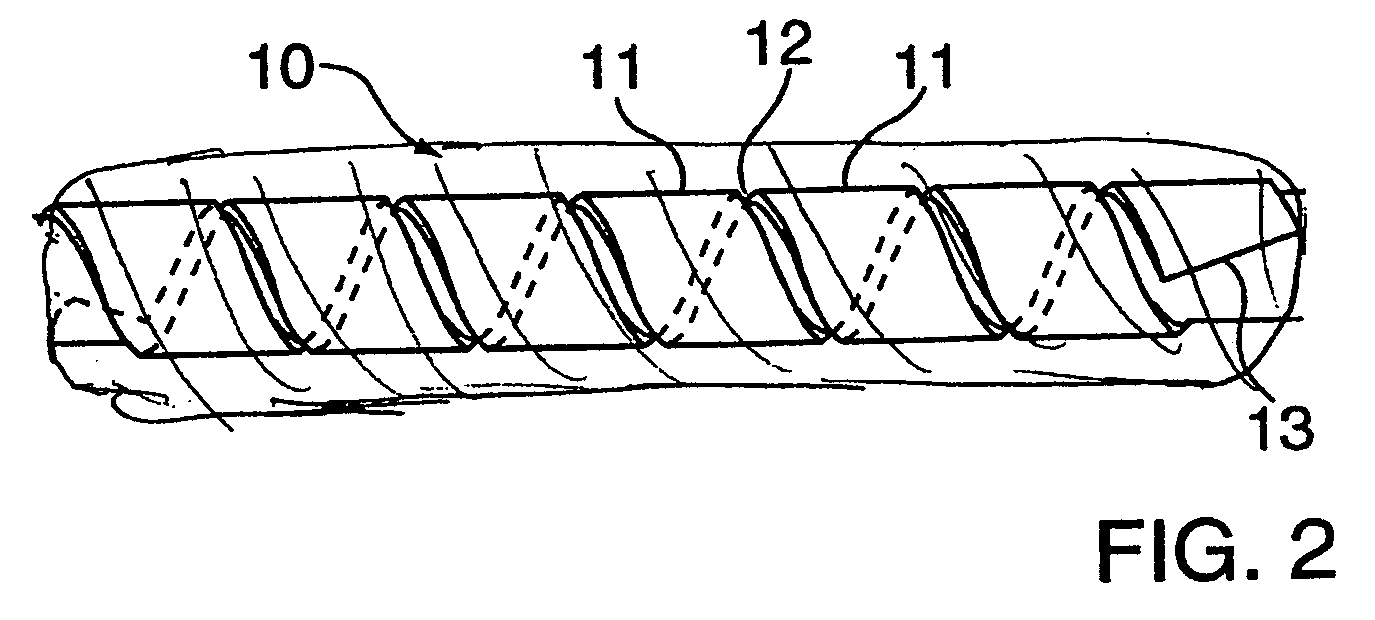 Hybrid amorphous metal alloy stent