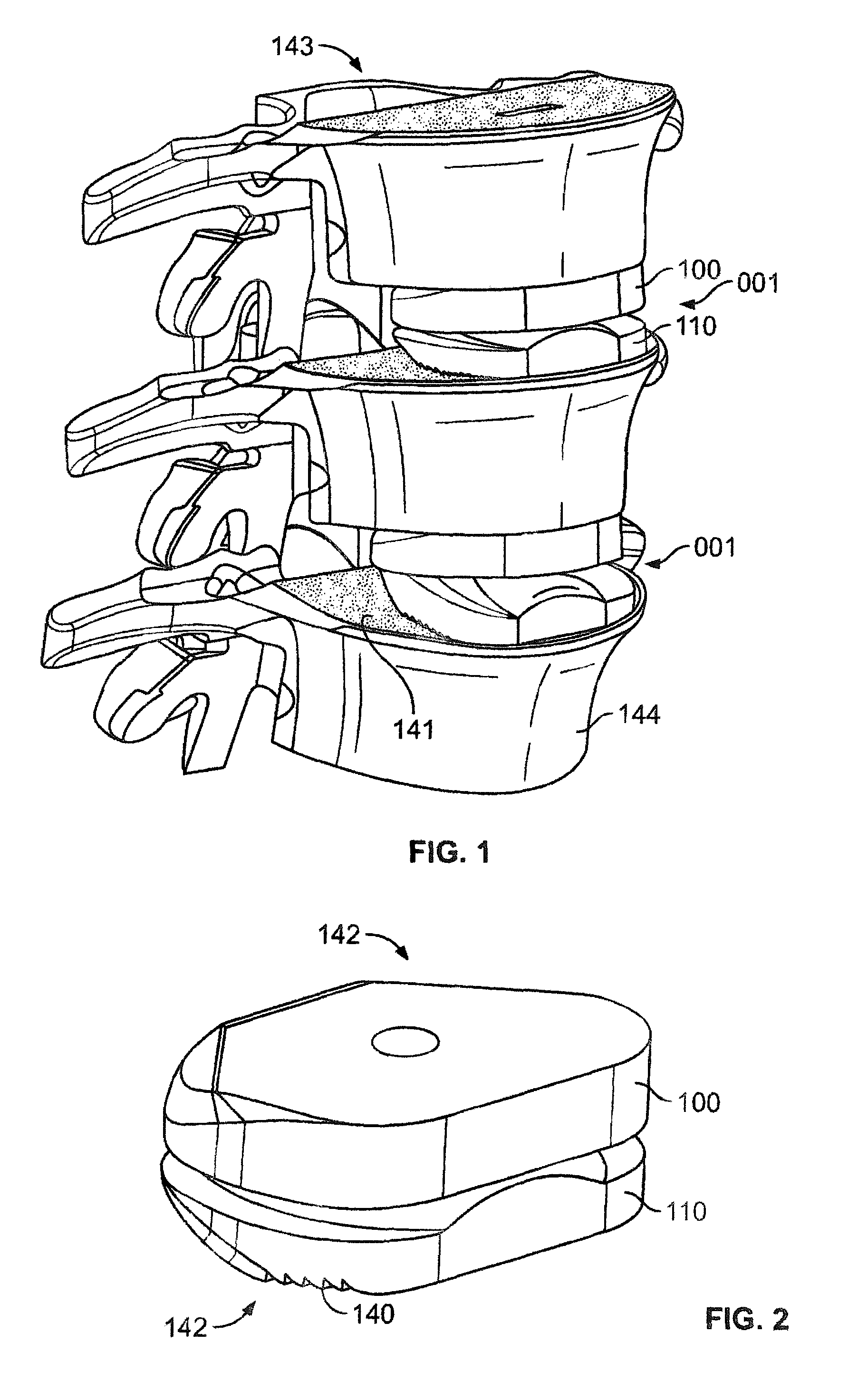 Systems and Apparatuses for Inserting an Implant in Intervertebral Space