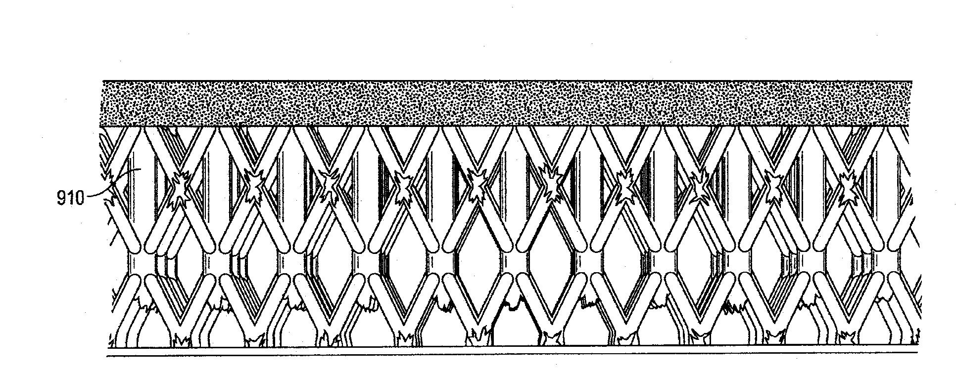 Energy absorbing truss structures for mitigation of injuries from blasts and impacts