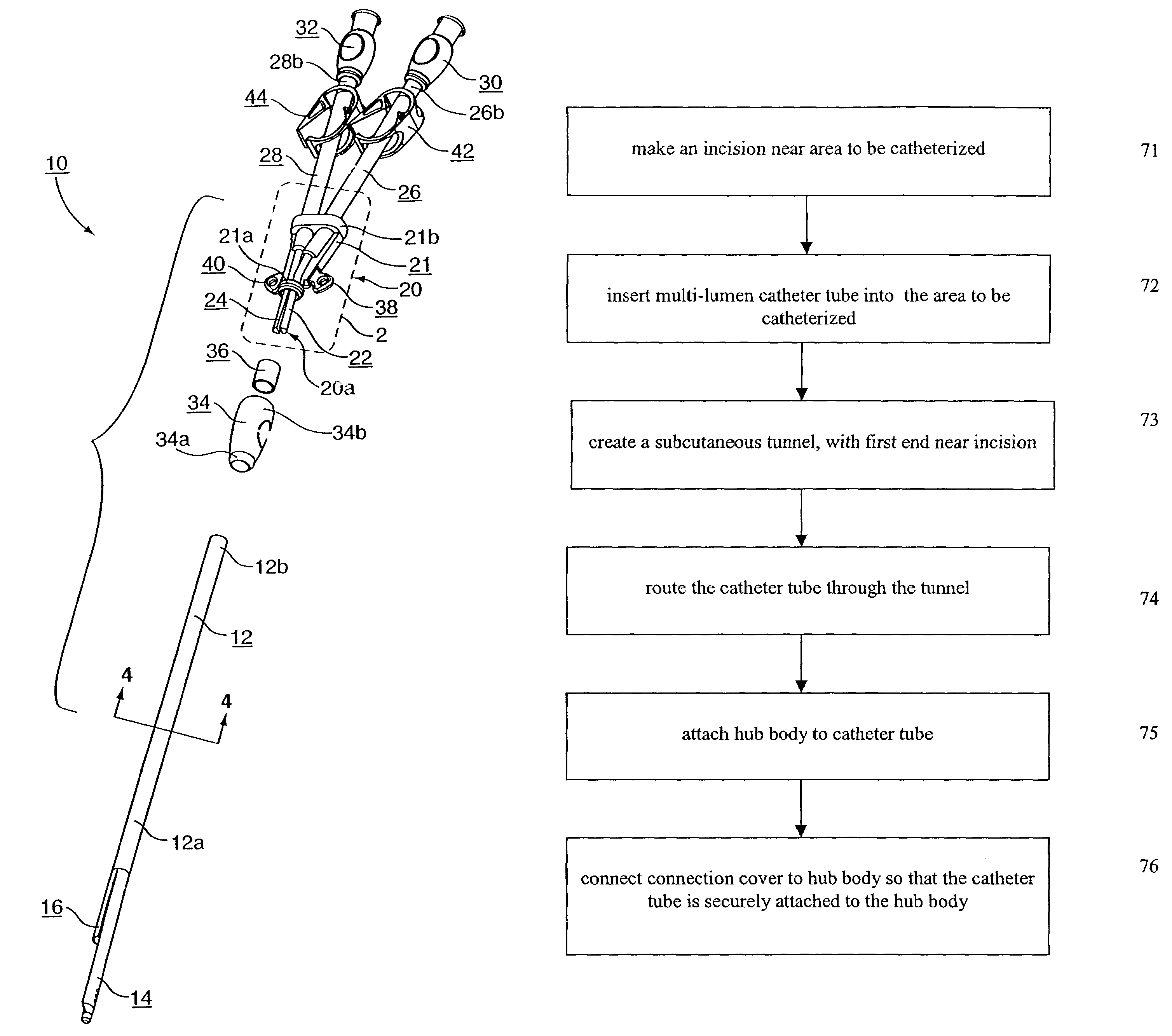 Multi-lumen catheter with attachable hub