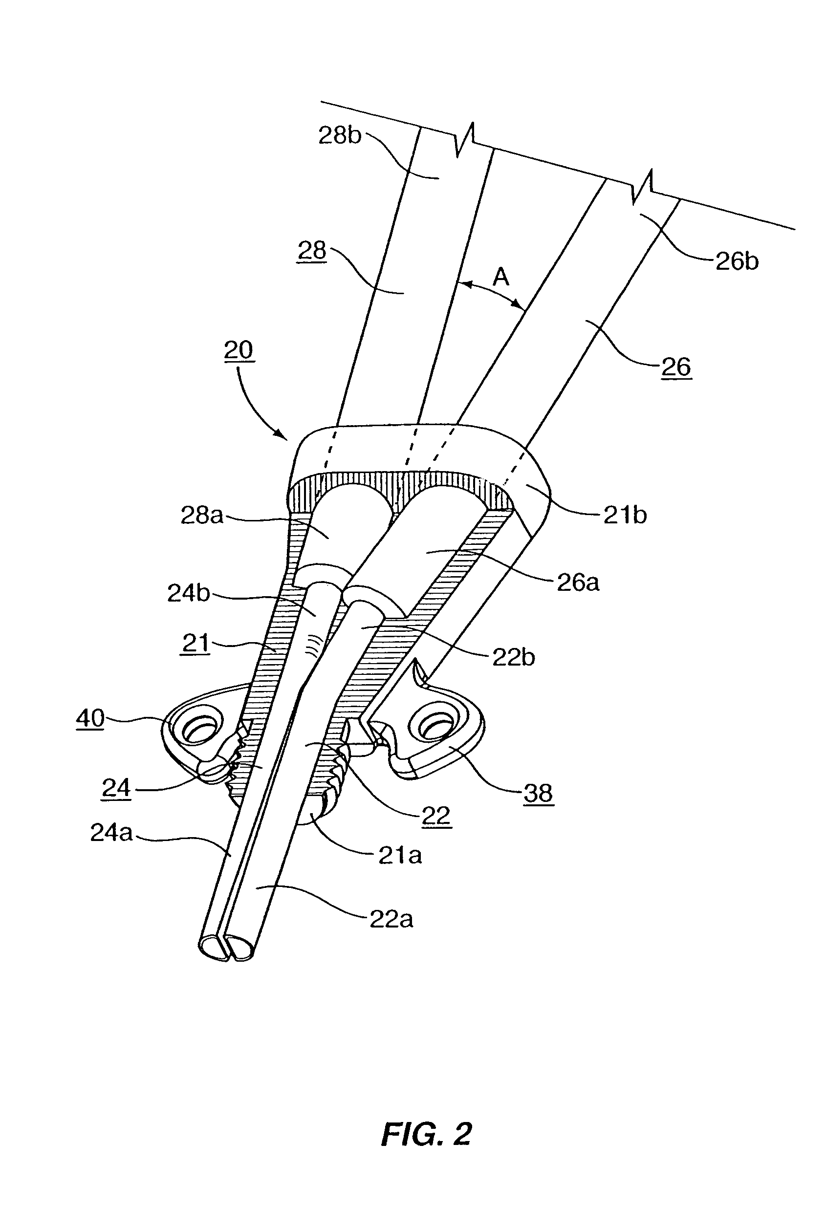 Multi-lumen catheter with attachable hub