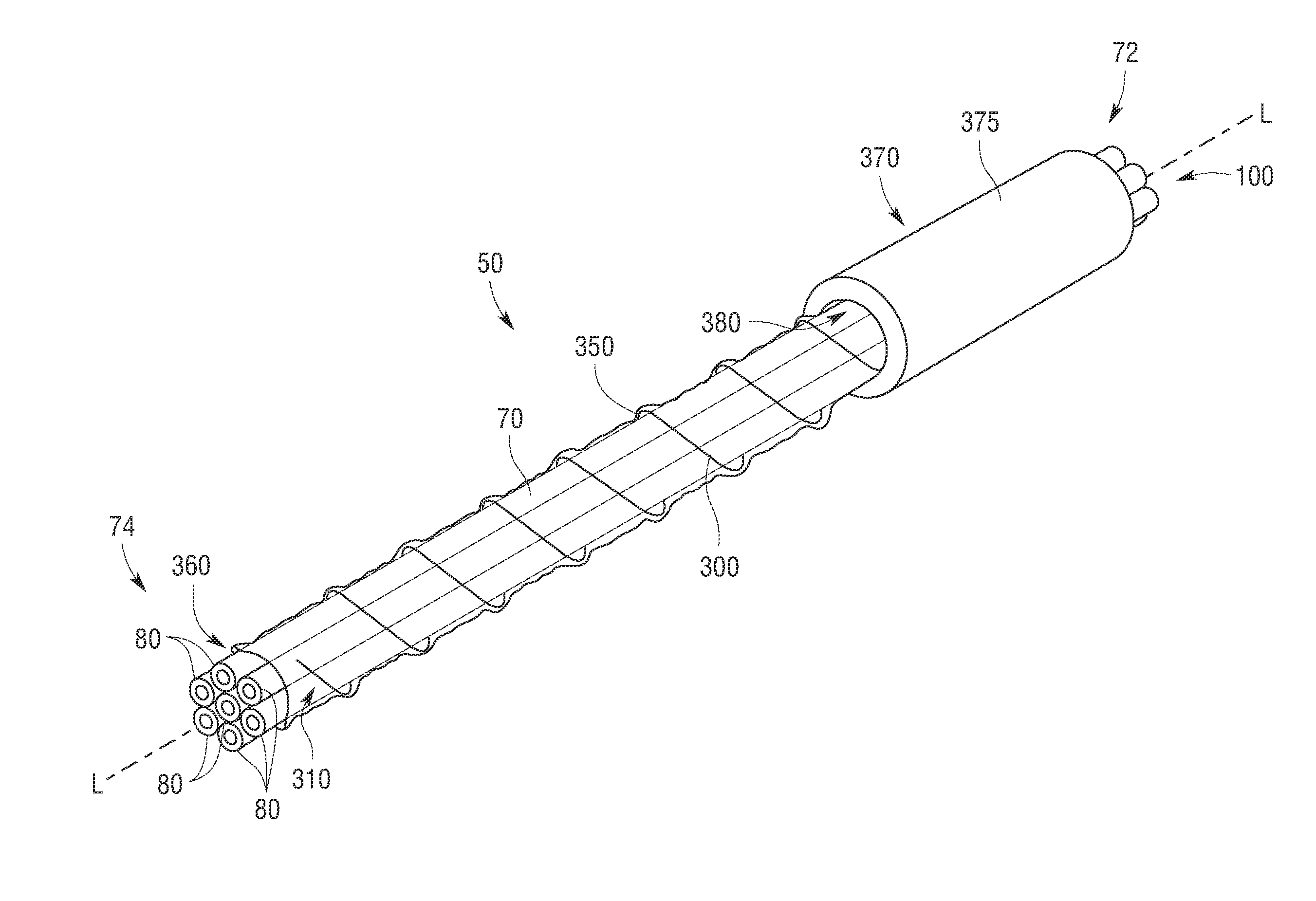 Manipulatable guide system and methods for natural orifice translumenal endoscopic surgery