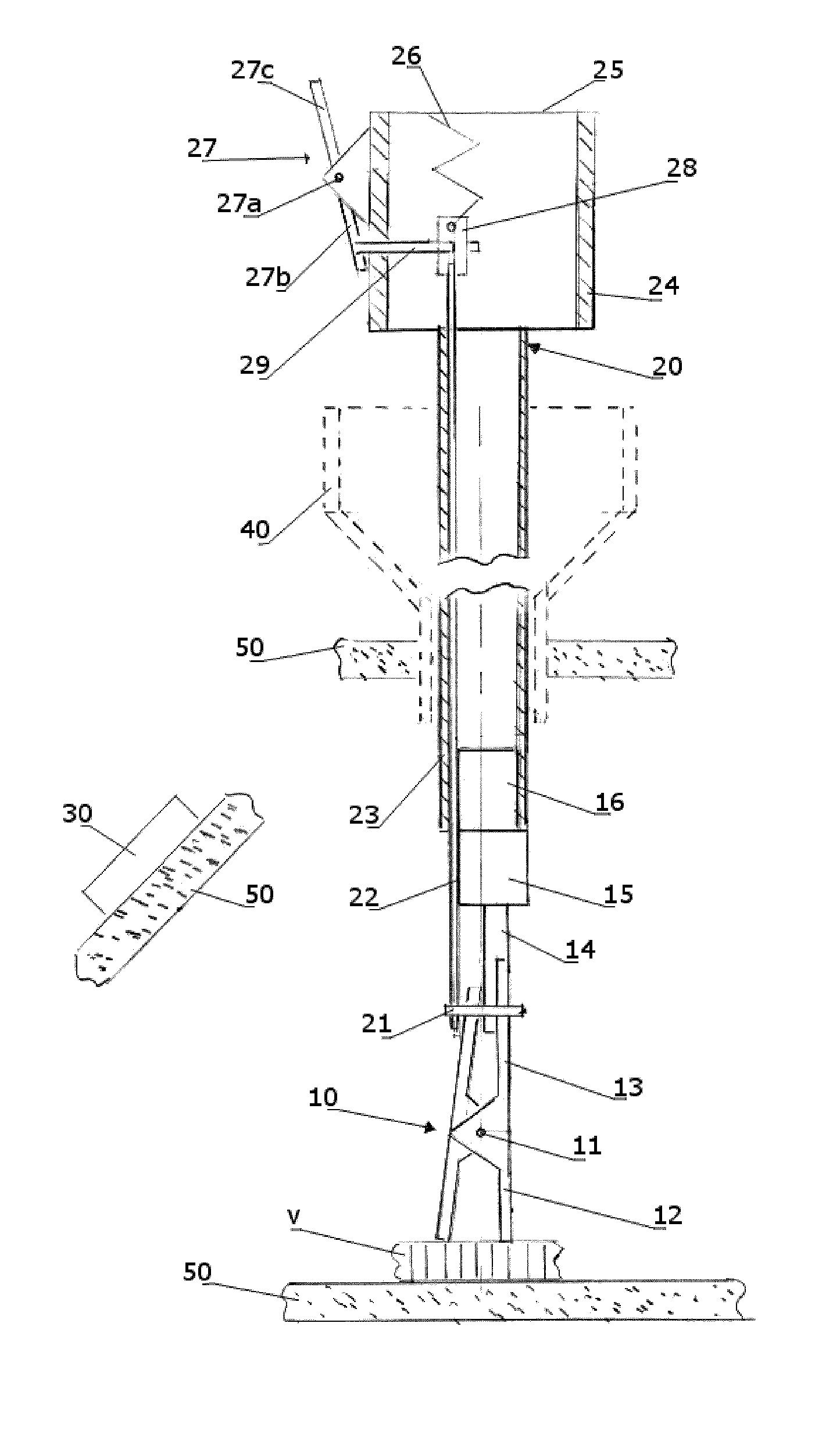 Remote traction and guidance system for mini-invasive surgery