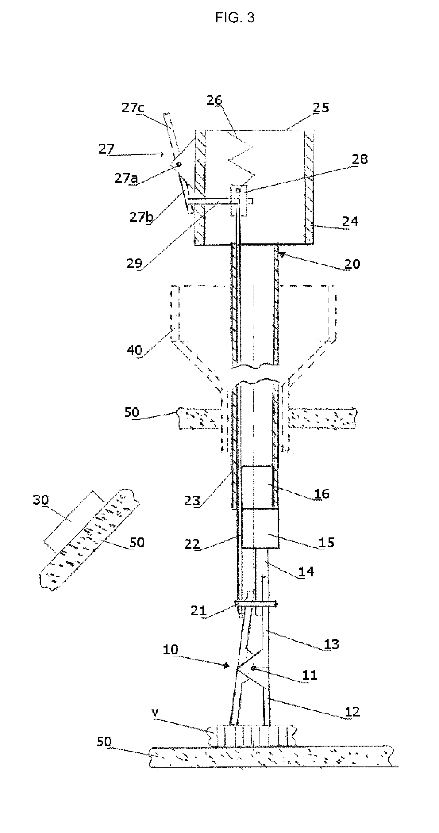 Remote traction and guidance system for mini-invasive surgery