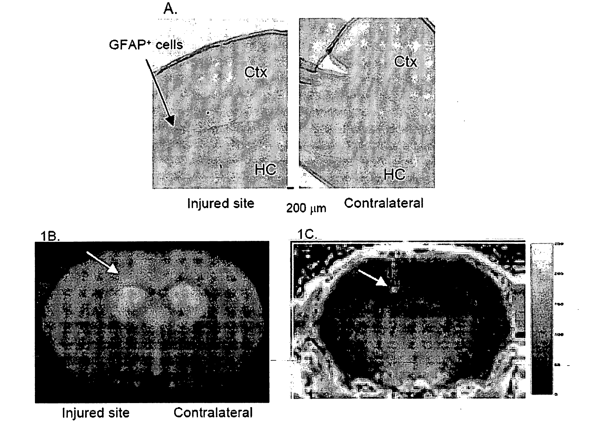 Targeting Brain Cells Via Ophthalmic Delivery