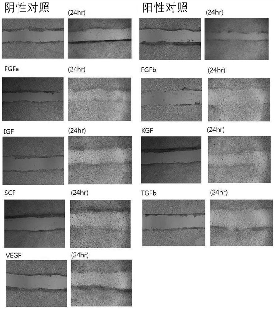 Composition for treating hair loss or promoting hair growth comprising growth factor