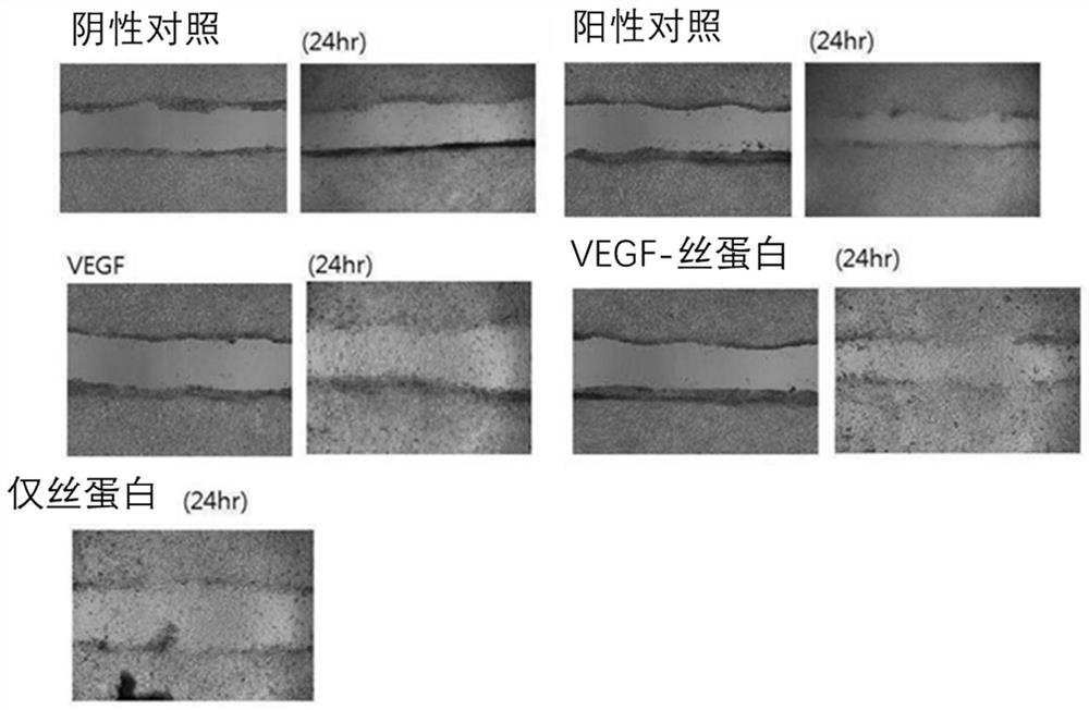 Composition for treating hair loss or promoting hair growth comprising growth factor