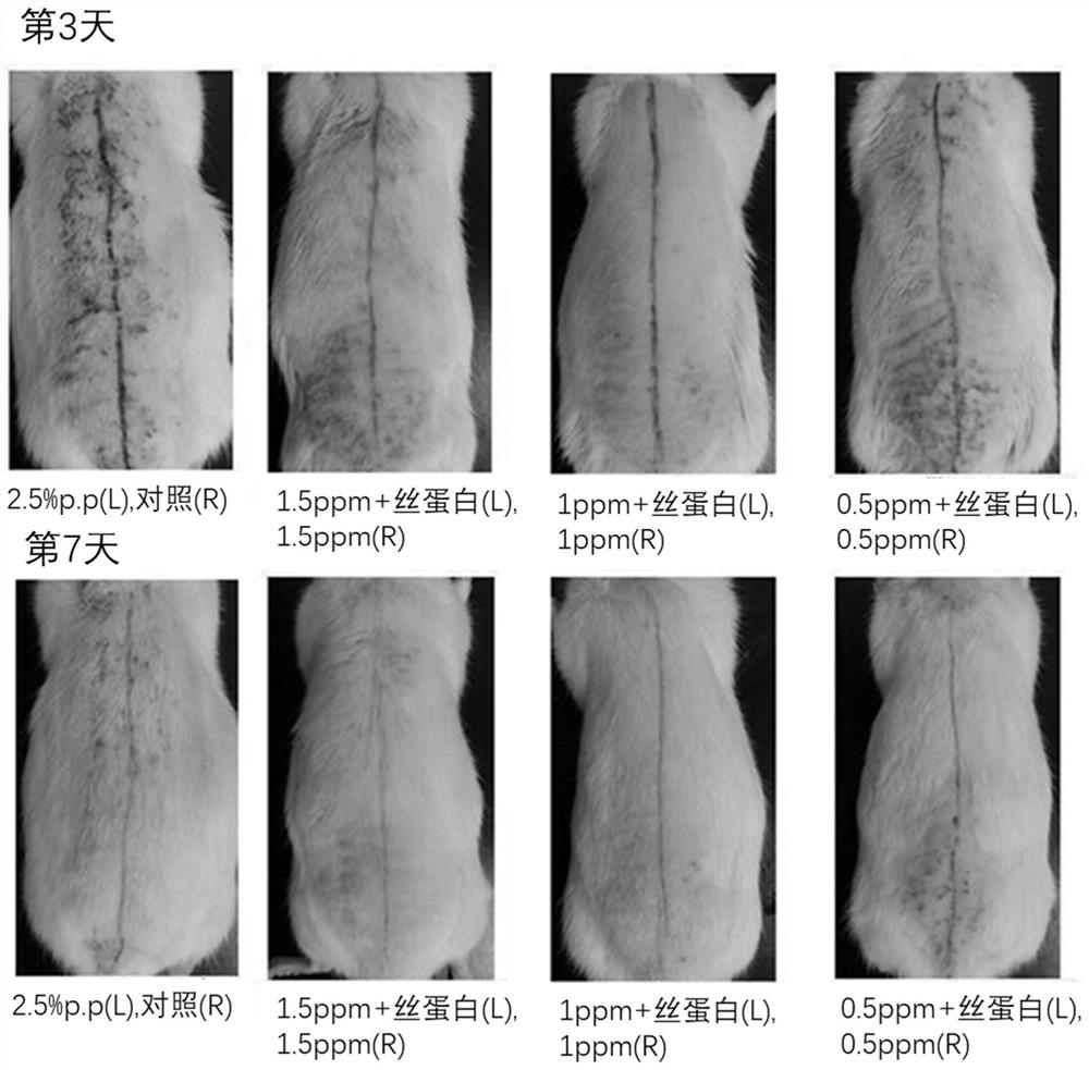 Composition for treating hair loss or promoting hair growth comprising growth factor