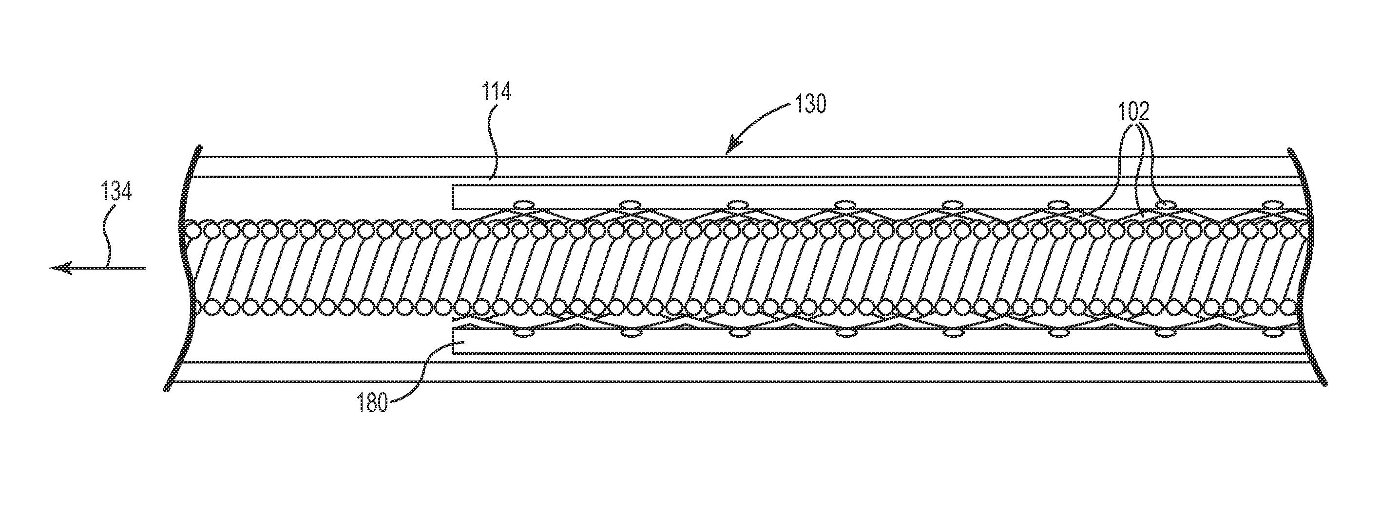 Lead with braided reinforcement