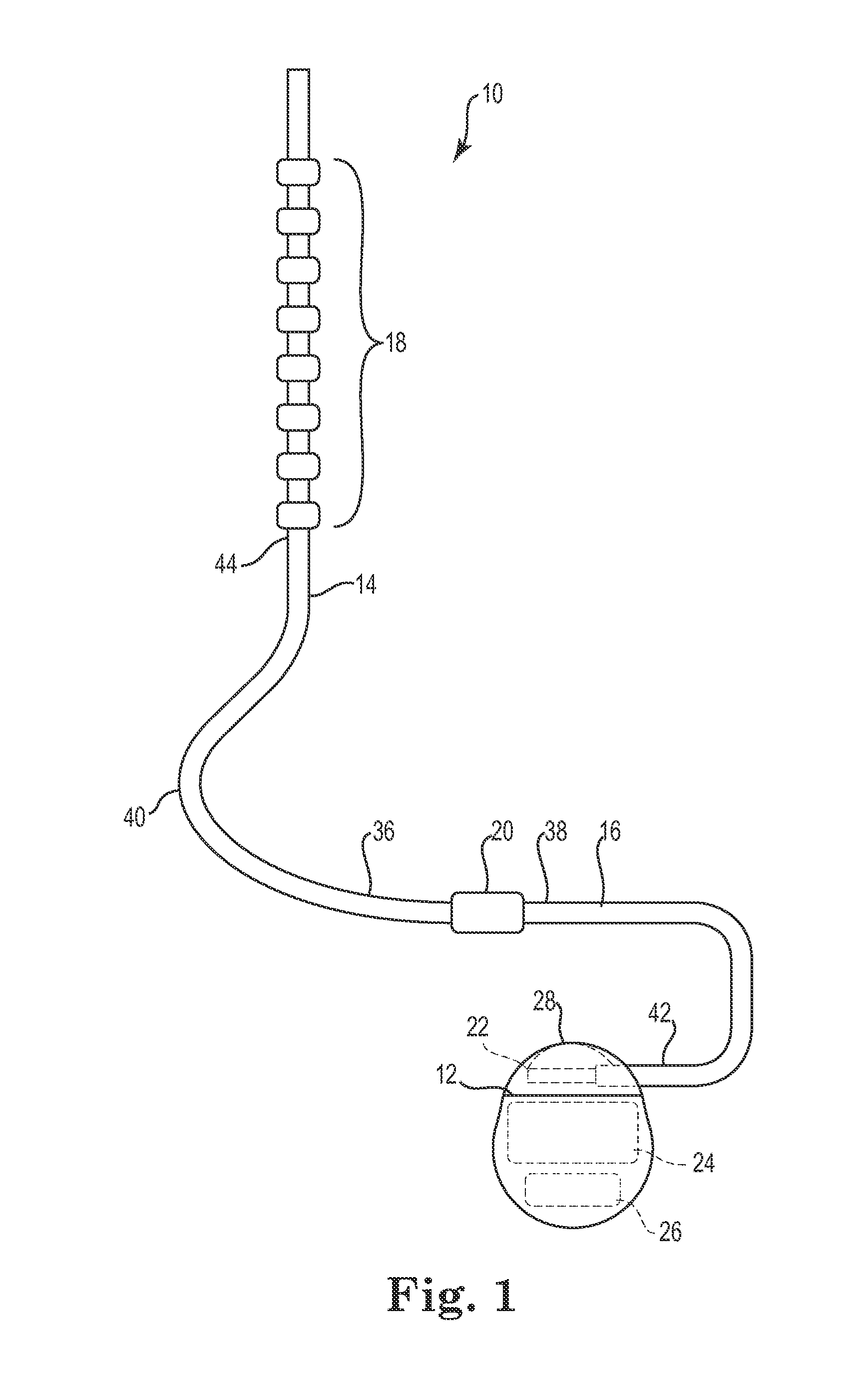 Lead with braided reinforcement